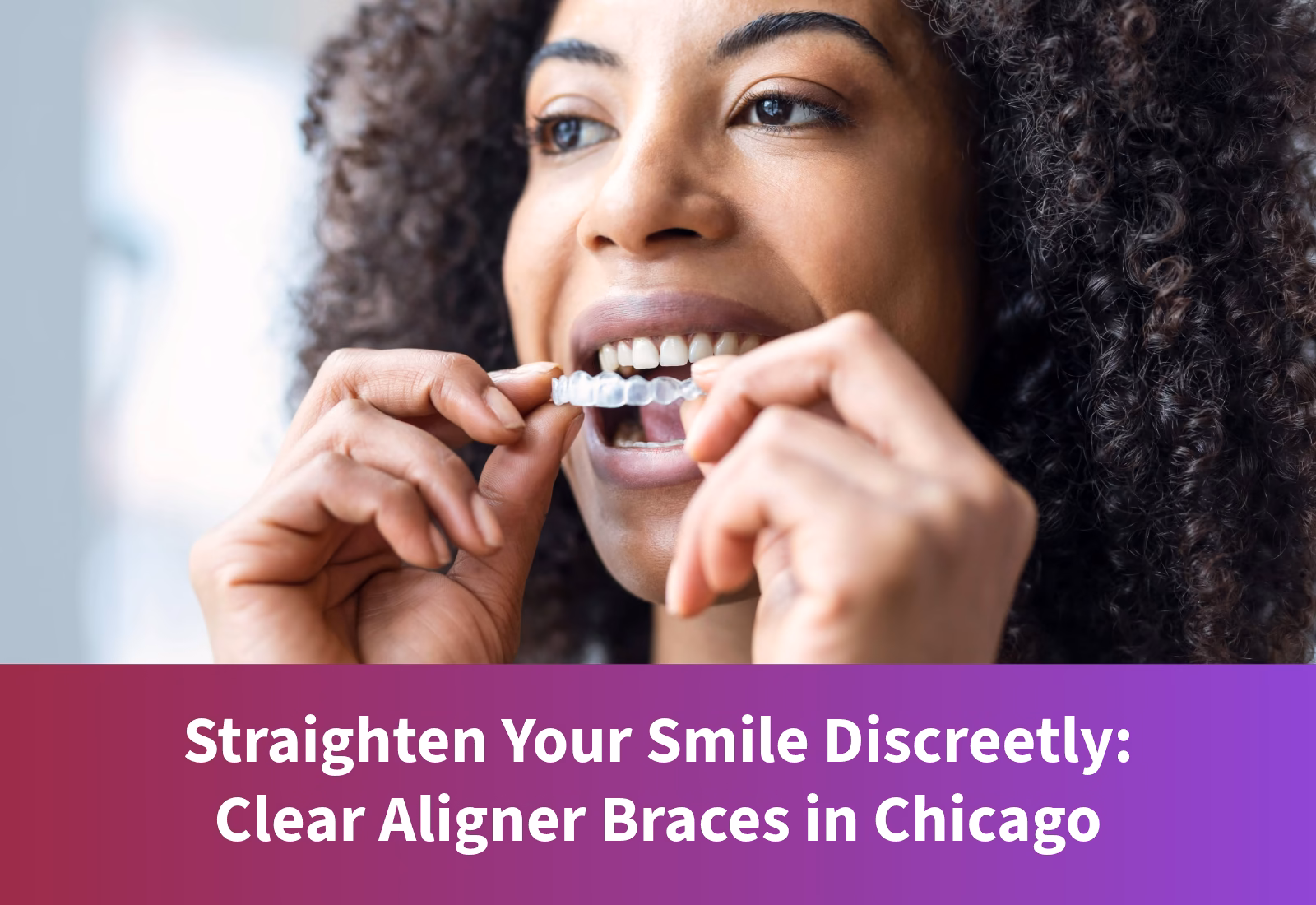 Clear Aligner Braces in Chicago