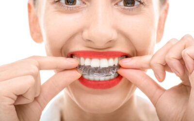 Chicago Invisalign Vs. Regular Braces:  Choosing the Right Orthodontic Treatment