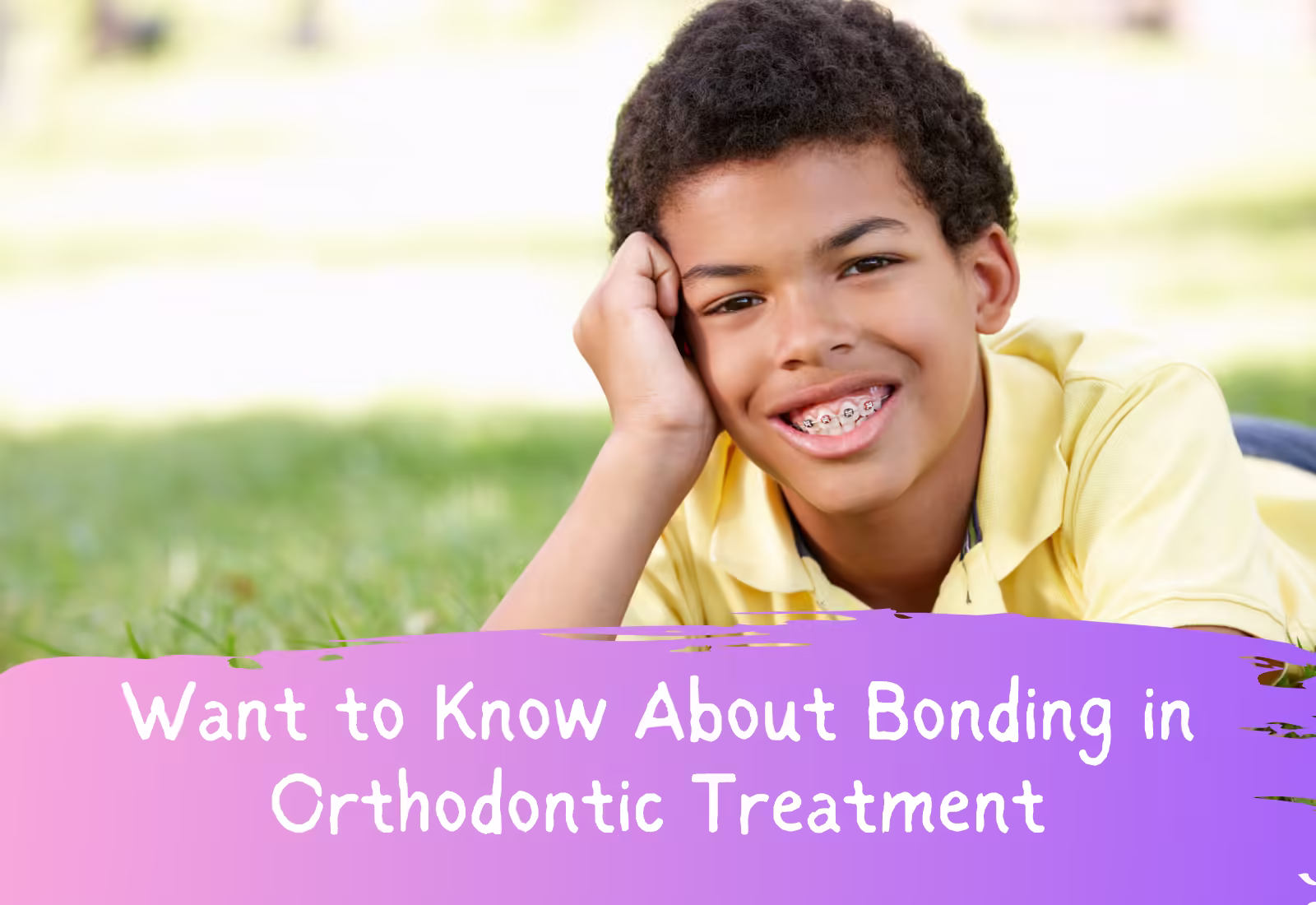 Want to Know About Bonding in Orthodontic Treatment