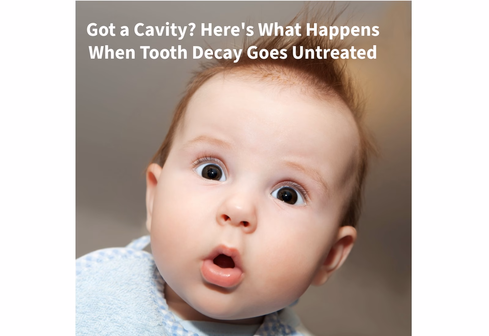What Happens When Tooth Decay Goes Untreated
